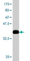 Anti-ACAA2 Mouse Monoclonal Antibody [clone: 2F7]