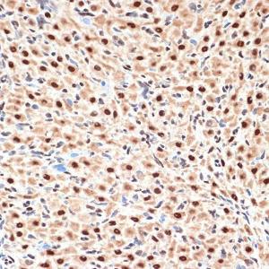 Immunohistochemistry analysis of paraffin-embedded rat ovary using Anti-Apc6 Antibody [ARC2053] (A306640) at a dilution of 1:100 (40x lens) Perform microwave antigen retrieval with 10 mM Tris/EDTA buffer pH 90 before commencing with IHC staining protocol