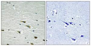 Immunohistochemical analysis of paraffin-embedded human brain using Anti-Trk A (phospho Tyr757) Antibody. The right hand panel represents a negative control, where the antibody was pre-incubated with the immunising peptide