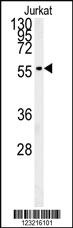 Anti-PLIN2 Rabbit Polyclonal Antibody