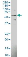 Anti-IL1R1 Mouse Polyclonal Antibody