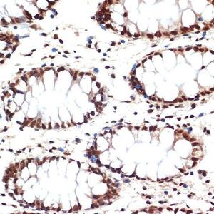 Immunohistochemistry analysis of paraffin-embedded human colon tissue using Anti-Apc6 Antibody [ARC2053] (A306640) at a dilution of 1:100 (40x lens) Perform microwave antigen retrieval with 10 mM Tris/EDTA buffer pH 90 before commencing with IHC staining protocol