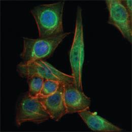 Anti-TUBB3 Mouse Monoclonal Antibody [clone: 2E9]