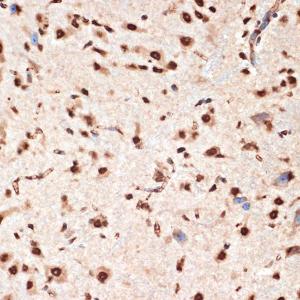 Immunohistochemistry analysis of paraffin-embedded mouse spinal cord using Anti-Apc6 Antibody [ARC2053] (A306640) at a dilution of 1:100 (40x lens) Perform microwave antigen retrieval with 10 mM Tris/EDTA buffer pH 90 before commencing with IHC staining protocol