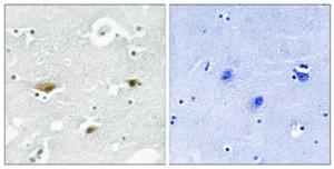 Immunohistochemical analysis of paraffin-embedded human brain using Anti-STK39 (phospho Ser325) Antibody. The right hand panel represents a negative control, where the antibody was pre-incubated with the immunising peptide