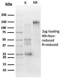 SDS-PAGE analysis of Anti-ERK2 Antibody [PCRP-MAPK1-1D1] under non-reduced and reduced conditions; showing intact IgG and intact heavy and light chains, respectively SDS-PAGE analysis confirms the integrity and purity of the antibody