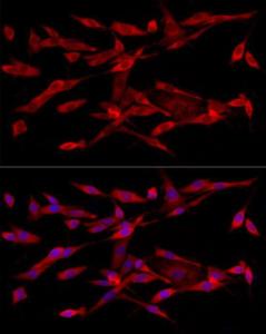 Immunofluorescence analysis of PC-12 using Anti-ABCA1 Antibody [ARC54239] (A305579) at a dilution of 1:200ã€1:1000 (40X lens). DAPI was used to stain the cell nuclei (blue)