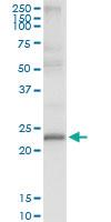 Anti-TXNDC9 Polyclonal Antibody Pair