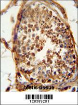 Anti-DNAJB13 Rabbit Polyclonal Antibody (FITC (Fluorescein Isothiocyanate))