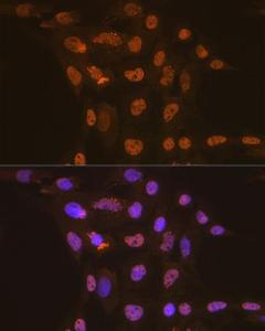 Immunofluorescence analysis of C6 cells using Anti-Apc6 Antibody [ARC2053] (A306640) at a dilution of 1:100 (40x lens) DAPI was used to stain the cell nuclei (blue)