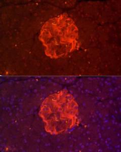 Antibody anti-TSPAN7 100 µl