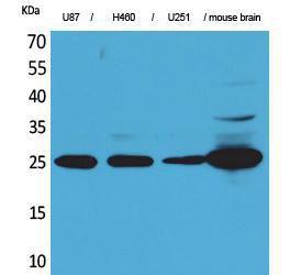 Western blot analysis of U87, H460, U25 mouse brain cells using Anti-UCHL1 Antibody