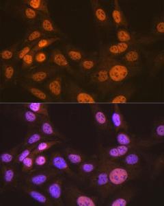 Immunofluorescence analysis of U-2 OS cells using Anti-Apc6 Antibody [ARC2053] (A306640) at a dilution of 1:100 (40x lens) DAPI was used to stain the cell nuclei (blue)