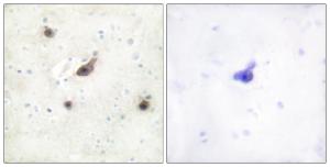 Immunohistochemical analysis of paraffin-embedded human brain tissue using Anti-B-RAF Antibody. The right hand panel represents a negative control, where the antibody was pre-incubated with the immunising peptide