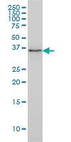 Anti-PARVG Mouse Monoclonal Antibody [clone: 4E1]