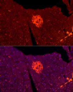 Antibody anti-TSPAN7 100 µl