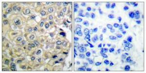 Antibody anti-FGFR3 100 µg