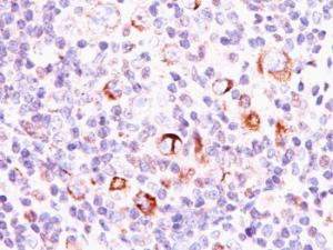 Immunohistochemical analysis of formalin-fixed, paraffin-embedded Hodgkin's lymphoma using Anti-Bcl-X Antibody [SPM337]