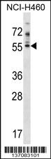 Anti-PDE7A Rabbit Polyclonal Antibody