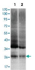 Anti-UBB Mouse Monoclonal Antibody [clone: 3C12]