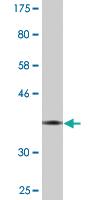 Anti-EED Mouse Monoclonal Antibody [clone: 3B12]