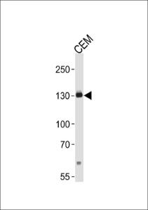 Anti-ERBB2 Rabbit Polyclonal Antibody (AP (Alkaline Phosphatase))