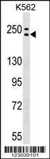 Anti-ADCY9 Rabbit Polyclonal Antibody (APC (Allophycocyanin))