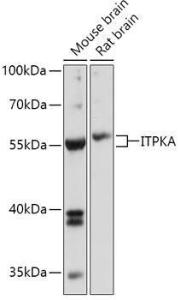 Western blot analysis of extracts of various cell lines, using Anti-ITPKA Antibody (A306642) at 1:1000 dilution. The secondary Antibody was Goat Anti-Rabbit IgG H&L Antibody (HRP) at 1:10000 dilution. Lysates/proteins were present at 25 µg per lane