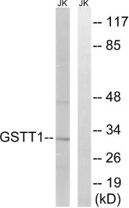 Anti-GSTT1 and GSTT4 antibody