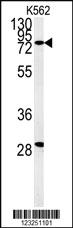 Anti-ZFYVE16 Rabbit Polyclonal Antibody