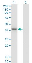 Anti-PARVG Mouse Monoclonal Antibody [clone: 4E1]