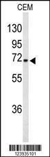 Anti-GABRA4 Rabbit Polyclonal Antibody (Biotin)