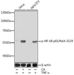 Western blot analysis of extracts of various cell lines, using Anti-NF-kB p65 (phospho Ser529) Antibody (A306643) at 1:1,000 dilutio