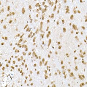 Immunohistochemistry analysis of paraffin-embedded mouse brain using Anti-PI3 Kinase p110 beta Antibody [ARC0703] (A309440) at a dilution of 1:20(40X lens). Perform high pressure antigen retrieval with 10 mM citrate buffer pH 6.0 before commencing with IHC staining protocol