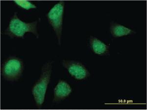 Anti-PFDN2 Mouse Monoclonal Antibody [clone: 2C1]