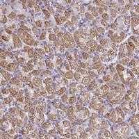 Anti-CFAP126 Rabbit Polyclonal Antibody