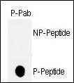 Anti-TP53 Rabbit Polyclonal Antibody (AP (Alkaline Phosphatase))