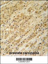 Anti-DKC1 Rabbit Polyclonal Antibody (HRP (Horseradish Peroxidase))