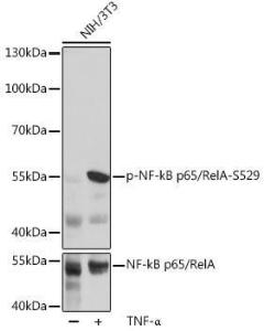 Western blot analysis of extracts of NIH/3T3 cells, using Anti-NF-kB p65 (phospho Ser529) Antibody (A306643) at 1:1,000 dilution or NF-kB p65 antibody (A16271