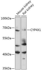 Anti-CYP4X1 antibody