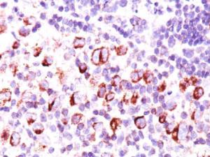 Immunohistochemical analysis of formalin-fixed, paraffin-embedded Hodgkin's lymphoma using Anti-Bcl-X Antibody [BX006 + 2H12]