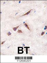 Anti-ERAS Rabbit Polyclonal Antibody (AP (Alkaline Phosphatase))