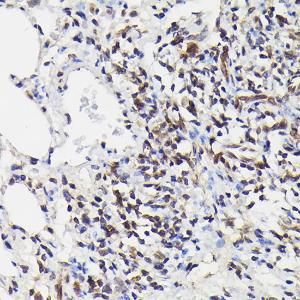 Immunohistochemistry analysis of paraffin-embedded rat lung using Anti-NF-kB p65 (phospho Ser529) Antibody (A306643) at a dilution of 1:100 (40x lens). Perform high pressure antigen retrieval with 10 mM citrate buffer pH 6.0 before commencing with IHC staining protocol.