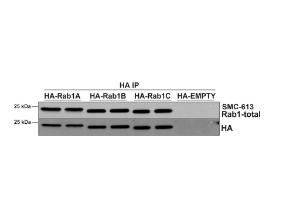 Immunoprecipitation analysis of HEK293 cells overexpressing human RAB1A, RAB1B, and RAB1C using Anti-Rab1A Antibody [4G10] (A304717)