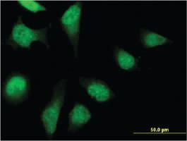 Anti-PFDN2 Mouse Monoclonal Antibody [clone: 2C1]