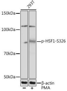 Anti-HSF1