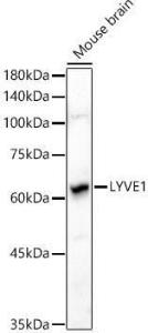 Western blot analysis of extracts of Mouse brain, using Anti-LYVE1 Antibody (A11976) at 1:1,000 dilution. The secondary antibody was Goat Anti-Rabbit IgG H&L Antibody (HRP) at 1:10,000 dilution.