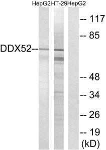 Western blot analysis of lysates from HepG2 and HT-29 cells using Anti-DDX52 Antibody. The right hand lane represents a negative control, where the antibody is blocked by the immunising peptide