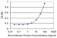 Anti-PFDN2 Mouse Monoclonal Antibody [clone: 2C1]