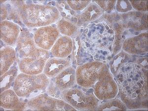 Anti-MAP1LC3A Rabbit Polyclonal Antibody